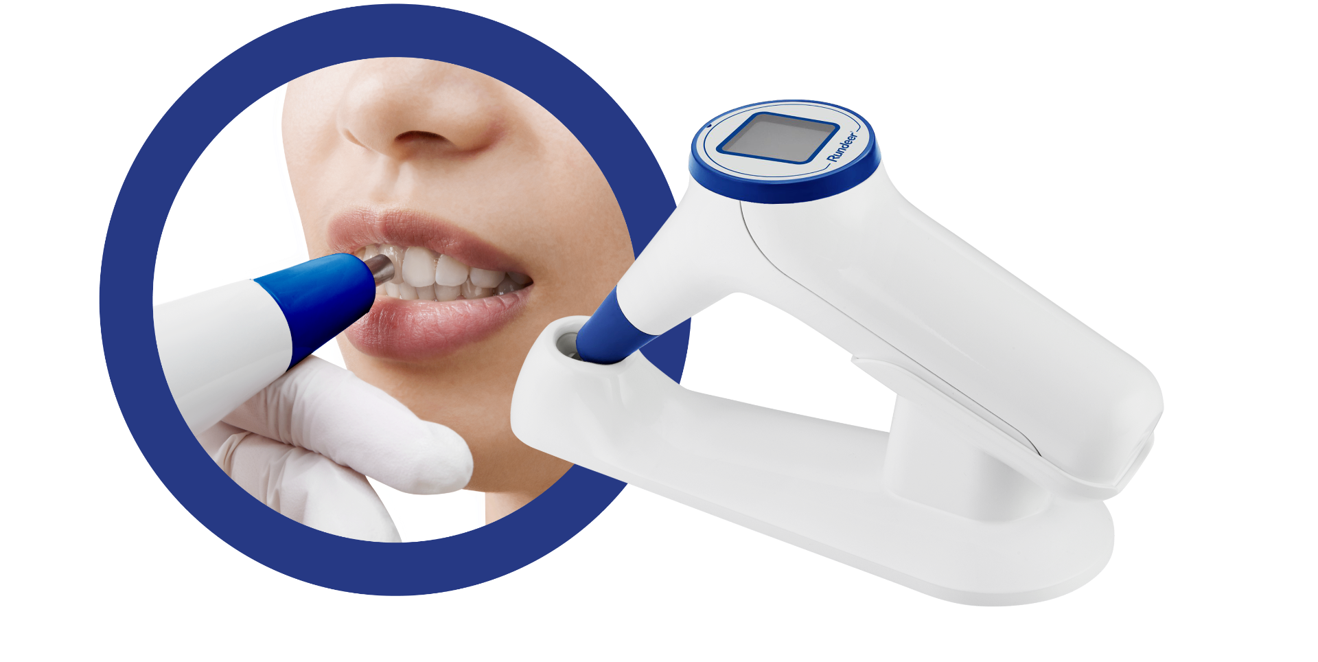 Sensor Rundeer Rundeer Dental Technologies - Advanced Digital Dentistry Solutions